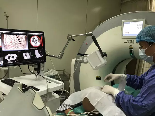 IQQA-Guide三維影像術(shù)中導(dǎo)航系統(tǒng)獲創(chuàng)新醫(yī)械特別審批，推動(dòng)精準(zhǔn)醫(yī)療新發(fā)展